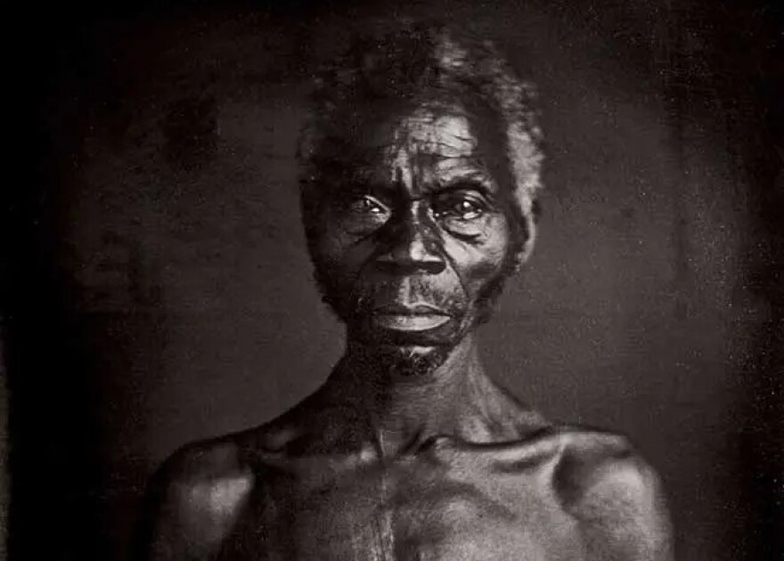 Enslaved African Renty Taylor photographed against his will in 1850 as part of a Harvard University project in South Carolina.
