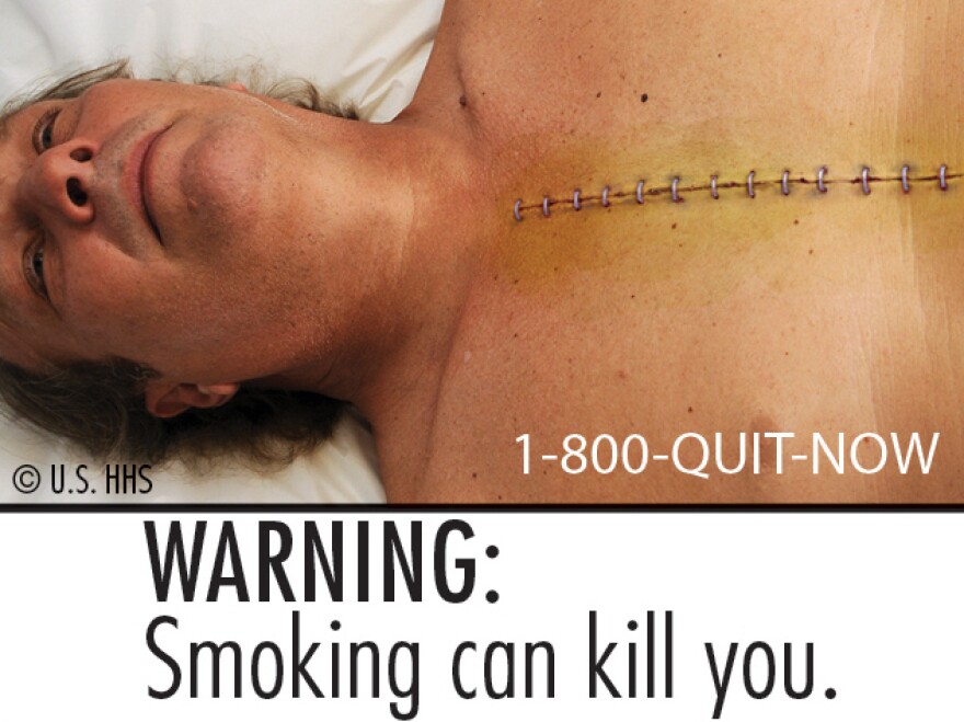 do cigarettes make you skinny Truth About Smoking: Does It Cause Weight Loss?