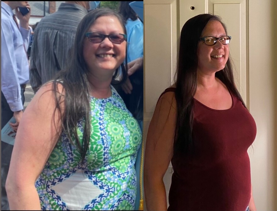 Amy Pacanza Rogers, the self-described foodie, has lost 47 pounds due to her parosmia. She has to remember to eat meals. And she wears a nose plug to block out odors. At home, while her daughter and husband share a cooked meal, she eats alone in an office. She says the condition is lonely.