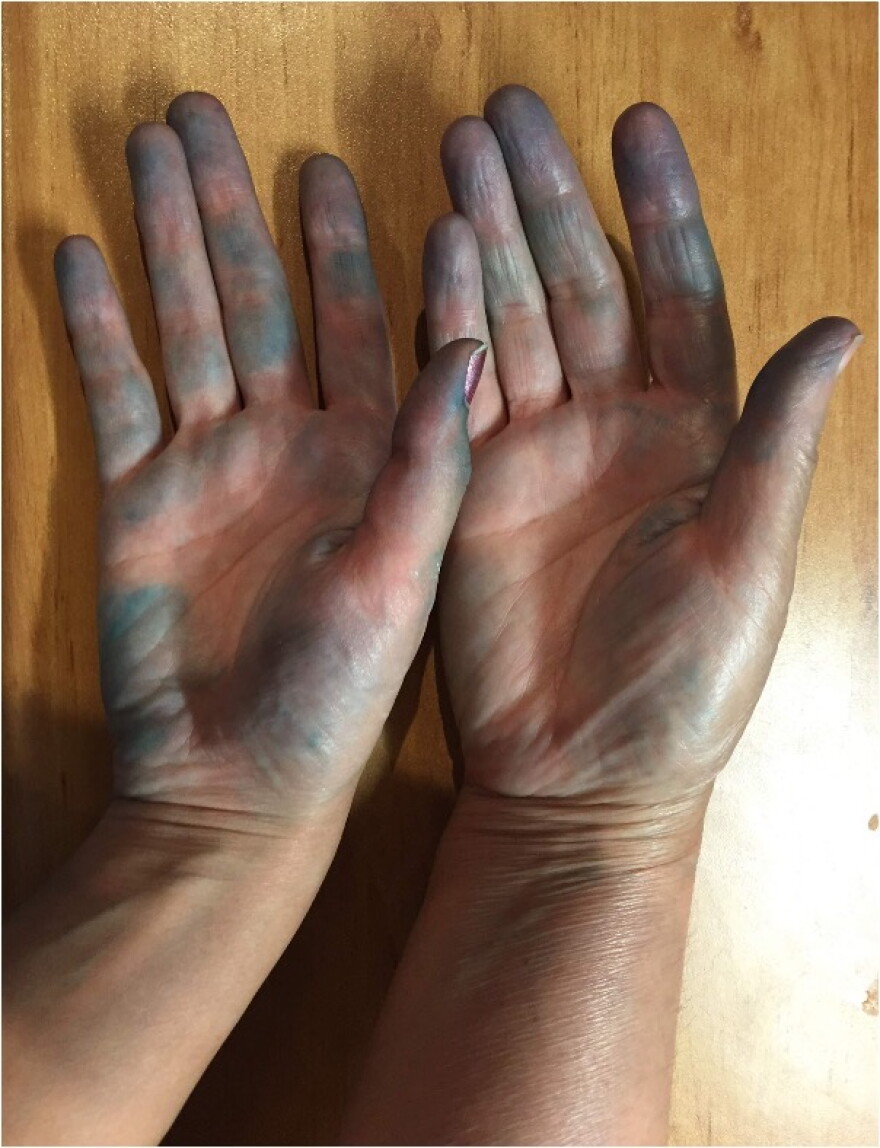 A 2016 photo of Leila Seyedzadeh dyed hand next to her mother's hand.