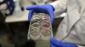 A scientist holds a tray of stem cells in a lab, in this file photo from 2010.