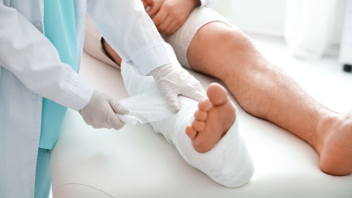 Doctor putting broken leg of young man in plaster