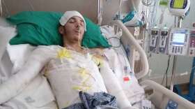 The Osceola County Sheriff's Office says Jean Barreto was severely burned when a deputy discharged a Taser at Wawa gas pump with gas on the ground and started a fire. Photo: Nejame Law