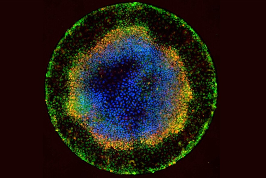 Embryoids like this one are created from stem cells and resemble very primitive human embryos. Scientists hope to use them to learn more about basic human biology and development.