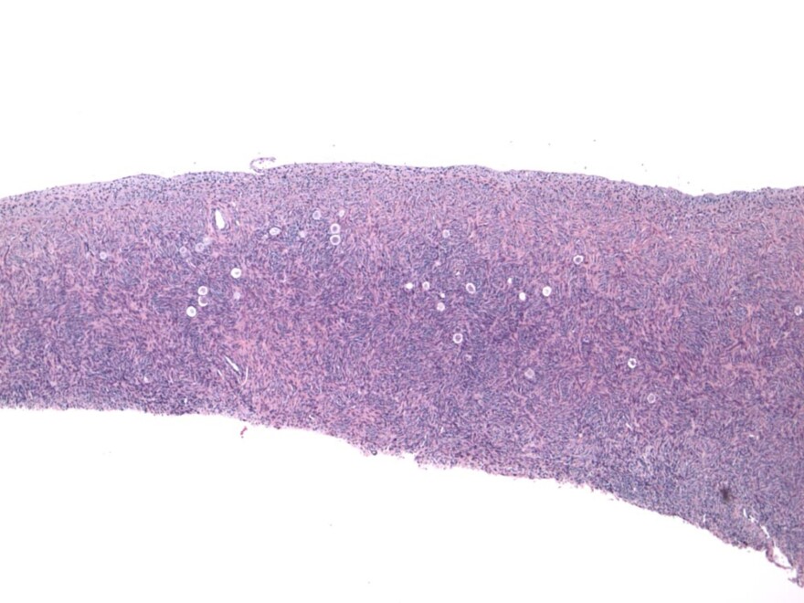 Doctors use tissue slides like this one of the ovary's outer cortex to confirm a woman's ovarian reserve. It's also the the ovary tissue that's removed in an ovarian transplant.