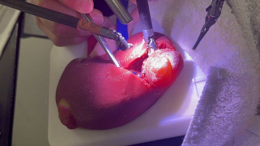 In this file photo, a Lazarus 3D kidney analog is used for a surgery rehearsal.
