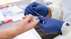 A health worker takes a drop of blood for the COVID-19 antibody test after at the Diagnostic and Wellness Center on May 5, 2020, in Torrance, California. (Valerie Macon/AFP/Getty Images)