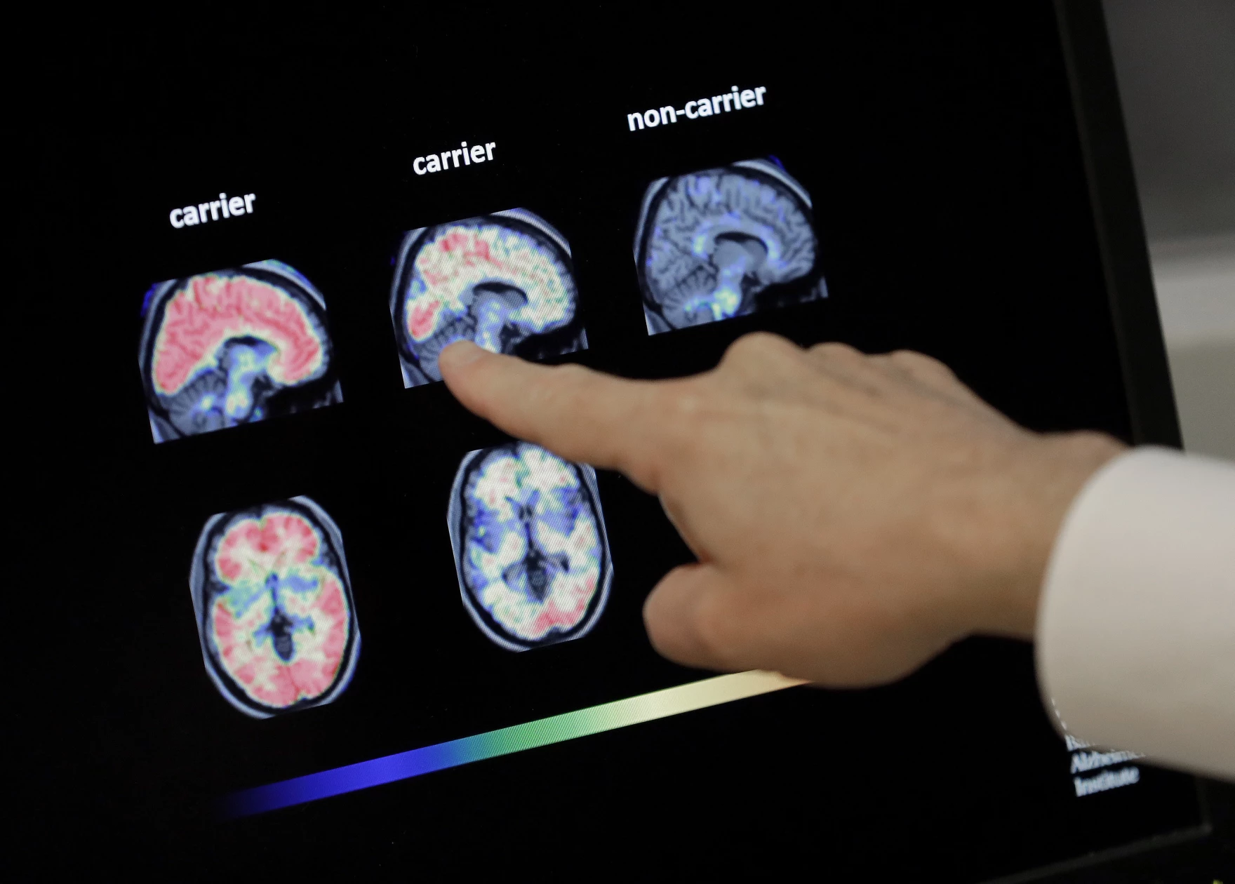 Maryland still ranks highest in dementia, scientists aren’t sure why