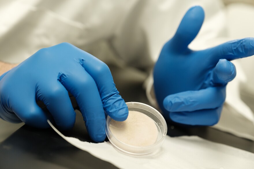 Biomedical engineer and entrepreneur Franco Kraiselburd shows a prototype of a product that could replace traditional bandages in his laboratory at Case Western Reserve University.