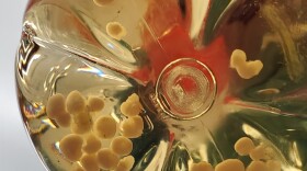 In Vitro Organoid Samples, courtesy of Dr. Cathryn Haigh, NIH/NIAD