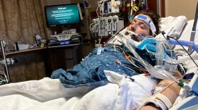 James Perkinson of Greenbriar, Tenn., underwent ECMO for nearly two months while he was sedated. He says without the "miracle" therapy, he "wouldn't be here right now."