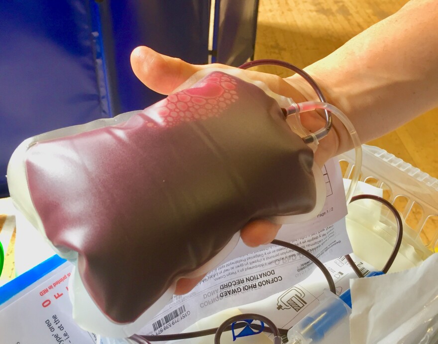 A unit of blood immediately after being donated.