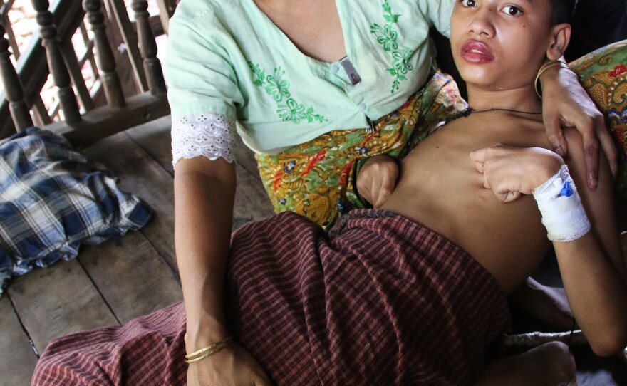 Zomir Hussein, 13, suffers from the effects of an accidental overdose of tuberculosis medicine. Because he is Rohingya, he is unable to go into Sittwe to the only hospital that can treat him. Most Rohingya are confined to camps for internally displaced persons, where there are few doctors.
