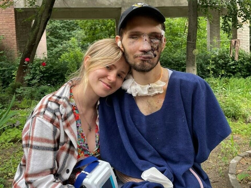 Alina and Andrii sit outside a hospital on June 25. The blast from an artillery shell tore off both of Andrii's arms above the elbow and shattered all the bones in his face, taking both of his eyes as well.