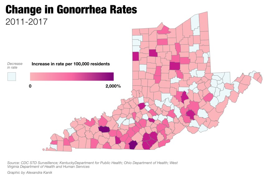 std-gonorrhea-change.jpg
