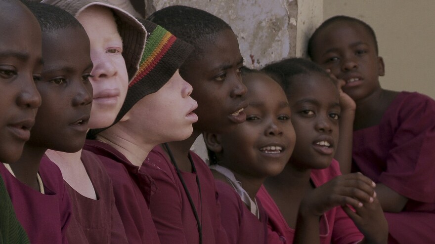 In countries around the African Great Lakes region, including Tanzania, some witch doctors believe that the body parts of people with albinism have magic power.