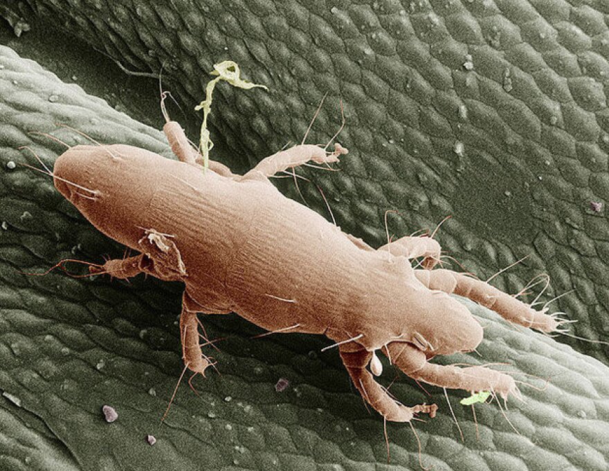 Oak Mites Are Back With A Vengeance In Kansas City KCUR Kansas City