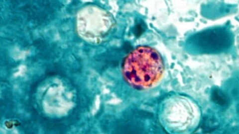 Cyclosporiasis is an intestinal infection that spreads when people ingest food or water contaminated with stool.