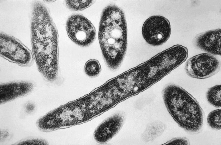 Legionella pneumophila bacteria at a very high magnification of 90,000X.