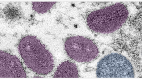 An image of the Monkeypox virus from the Centers for Disease Control and Prevention website.
