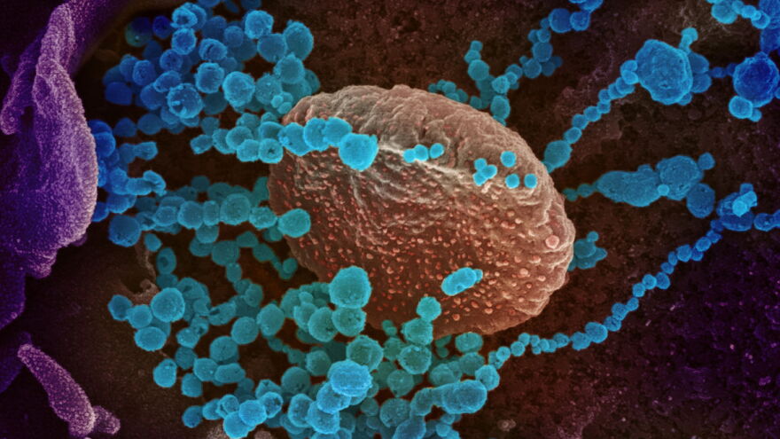 NIAID-RML/Science Source