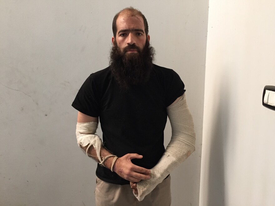 Ahmed Darwish appears in a police station in Rumeilan, northern Syria, after being captured by Kurdish fighters as he was running away from a battle. He was wounded in a coalition airstrike in support of anti-ISIS forces. "There was camaraderie, friendship, like a brotherhood between us," he says of his time in ISIS.
