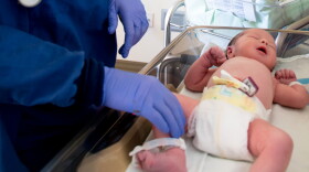 Baby Jacob weighs 7.14 pounds - some infants aren't as lucky.