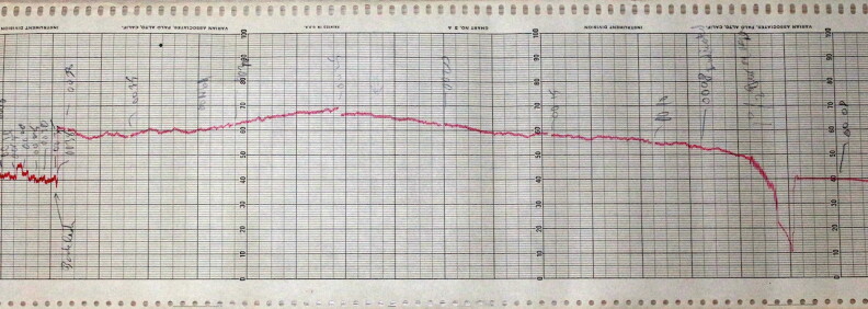 Chart paper from Frank Drake’s Project Ozma observation
