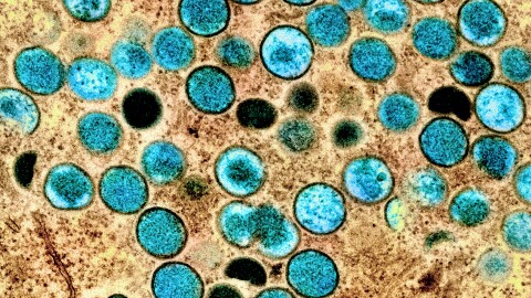 Colorized transmission electron micrograph of monkeypox particles (teal) found within an infected cell (brown), cultured in the laboratory. Image captured and color-enhanced at the NIAID Integrated Research Facility (IRF) in Fort Detrick, Maryland.