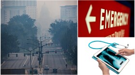 For several days, Boise's Air Quality Index has been "Unhealthy" or "very unhealthy."