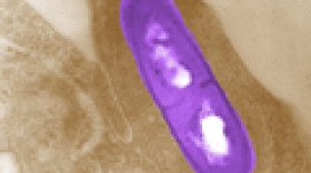Listeria monocytogenes
