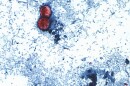 This undated photo taken through a microscope provided by the CDC shows Cyclospora cayetanensis oocysts found in a fresh stool sample which had been prepared with a formalin solution and stained with safranin.