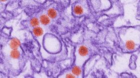 Particles of Zika virus are colored red in this transmission electron micrograph.