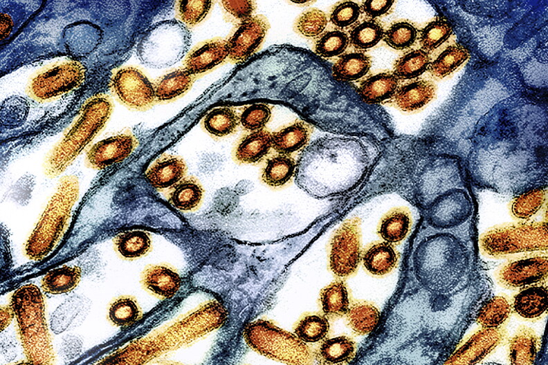 This colorized electron microscope image shows avian influenza A virus (bird flu) particles, red/yellow, grown in cultured cells. (CDC, NIAID via AP)