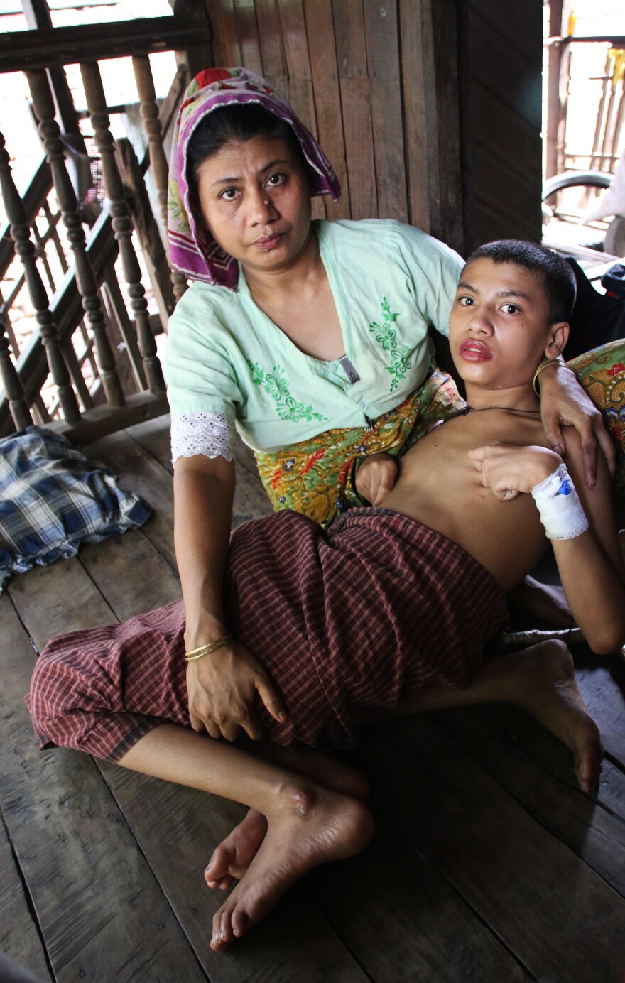 Zomir Hussein, 13, suffers from the effects of an accidental overdose of tuberculosis medicine. Because he is Rohingya, he is unable to go into Sittwe to the only hospital that can treat him. Most Rohingya are confined to camps for internally displaced persons, where there are few doctors.