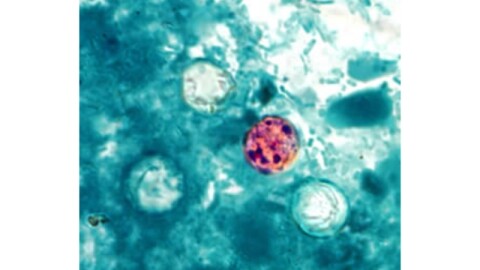 Cyclosporiasis outbreak caused by Cyclospora parasite spreads across Michigan