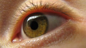There's a spectrum of how clearly humans can picture daydreams and memories.