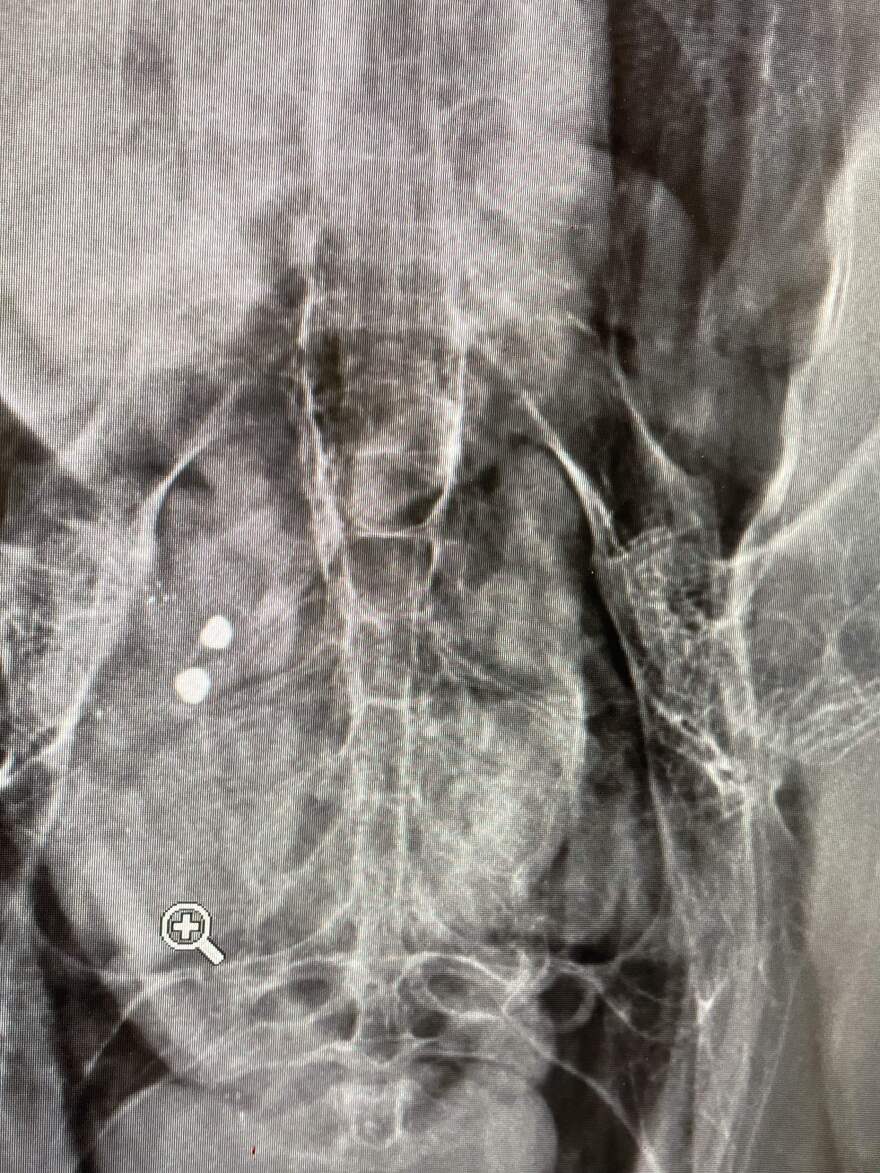 The image is a black and white x-ray showing large lead fragments within a condor's stomach