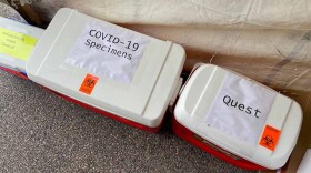 Foto de Mechelle Hankerson. El departmento de salud del estado usa resultos de 4,675 adultos para estimar cuantos en el estado tiene anticuerpos de COVID-19.