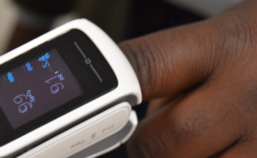 A pulse oximeter is worn by Brown University professor Kimani Toussaint. The devices have been shown in research to produce inaccurate results in dark-skinned people, and Toussaint's lab is developing technology that would be more accurate, regardless of skin tone.