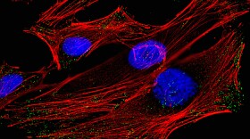 A fluorescence micrograph of HeLa cells, derived from cervical cancer cells taken from Henrietta Lacks and named in her honor