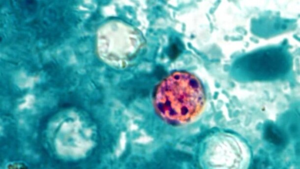 This photo shows four Cyclospora "oocysts" under a microscope. A Kansas woman is suing Taco Bell after she allegedly contracted the parasite from food there.