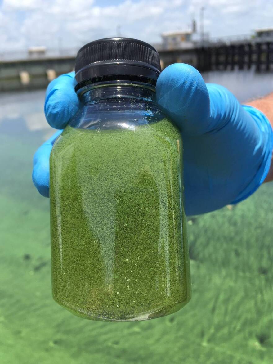 Algae collected from the Caloosahatchee River in 2018.