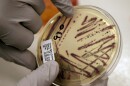 FILE - A microbiologist points out an isolated E. coli growth on an agar plate at the Washington State Department of Health, Nov. 3, 2015, in Shoreline, Wash. (AP Photo/Elaine Thompson, File)