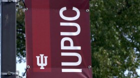 The Equal Protection Project is suing IUPUC, which will become IU Columbus on July 1, for its IU Columbus African American Fund Scholarship.