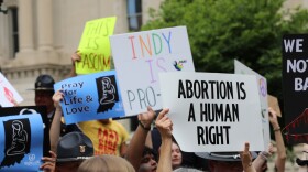 About 57 percent of people polled in the Indiana Public Broadcasting/Ball State Hoosier Survey said abortion should be legal in most or all cases.