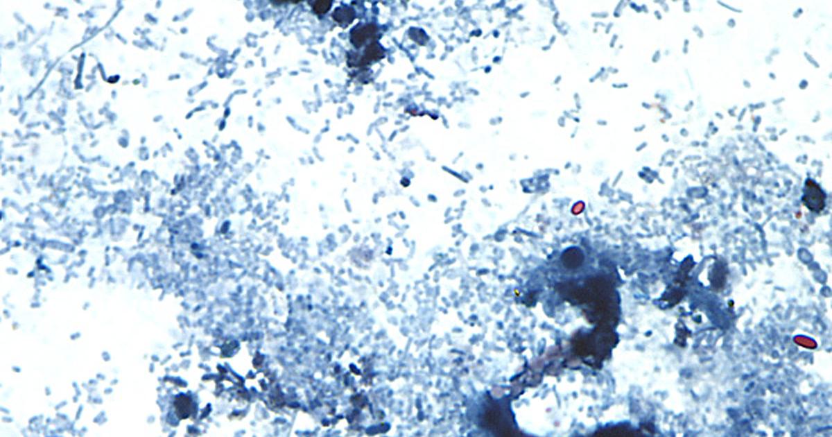 Maryland sees significant increase in cyclosporiasis cases