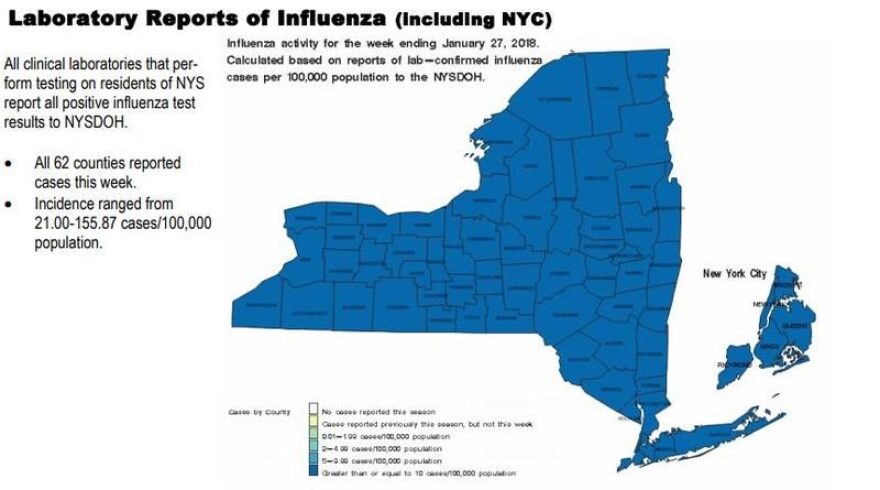 The flu remains prevalent around all of New York State HEALTH.NY.GOV