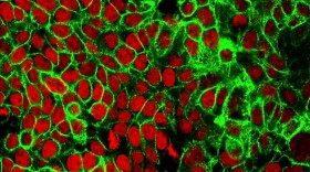 This microscope image from the National Cancer Institute Center for Cancer Research shows human colon cancer cells with the nuclei stained red. Americans should start getting screened for colon cancer at age 45, according to new guidelines from the U.S. Preventive Services Task Force.