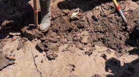 Water and mud can carry leptospira bacteria, especially after flooding events. Leptospirosis, while often mild, can lead to serious illness or death in a small percentage of cases, and health officials urge safety precautions for those exposed to post-storm flooding conditions.